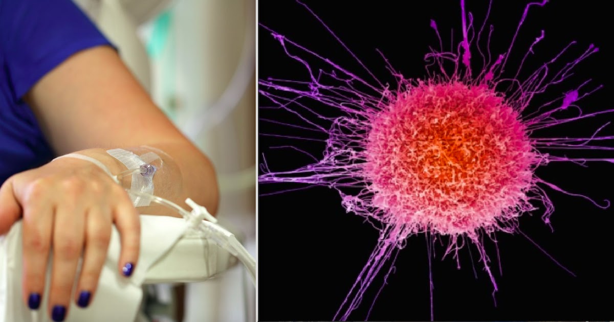 New Treatment Destroys Neck And Head Cancer Tumours In Terminally Ill Patients