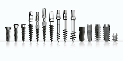 Dental Implant