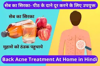 back acne treatment in hindi