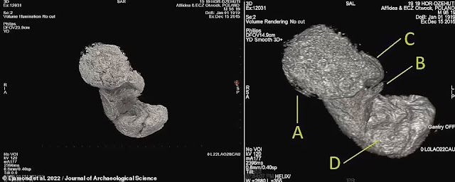 Το έμβρυο έμεινε στην ανέγγιχτη μήτρα. Στη φωτογραφία: δύο ογκομετρικές αποδόσεις του εμβρύου από τα δεδομένα CT. Οι ετικέτες στη δεξιά εικόνα αντιπροσωπεύουν το κεφάλι (A), το δεξί χέρι (B), το αριστερό χέρι (C) και το δεξί πόδι (D).  [Credit: Warsaw Mummy Project]