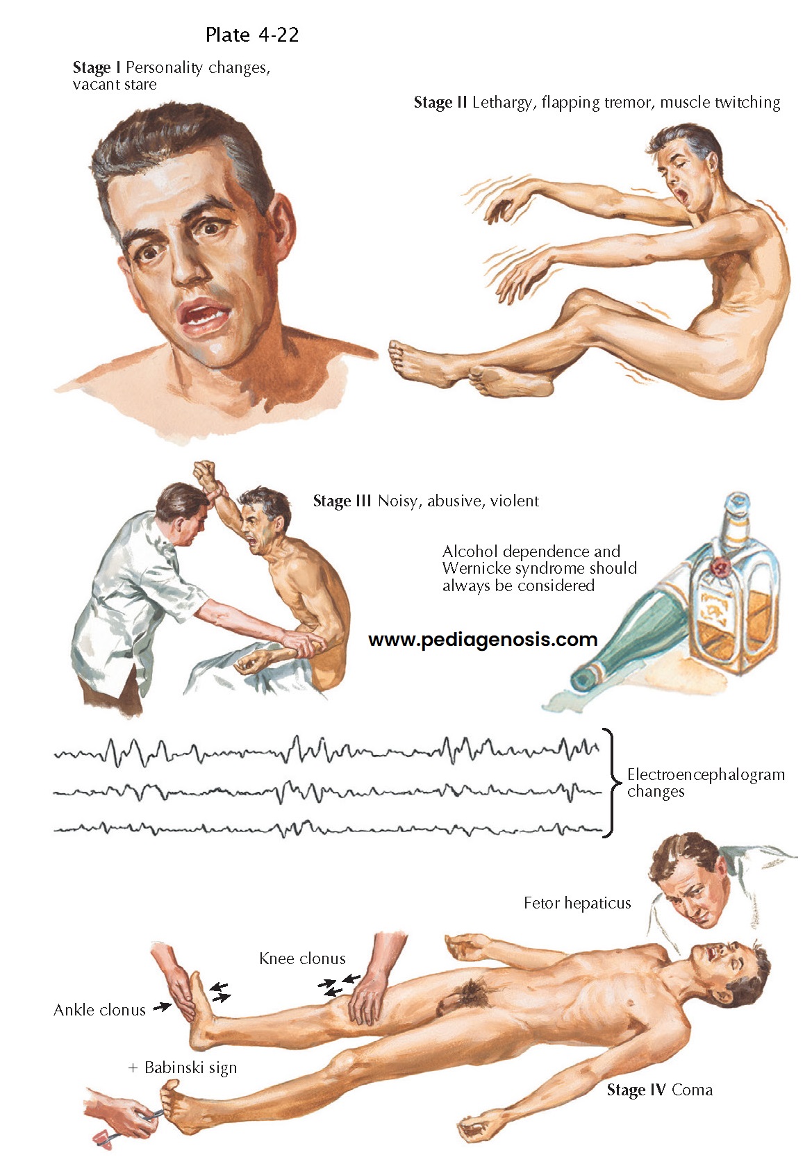 Delirium and Acute Personality Changes