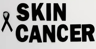 What is the most common skin cancer?_Ichhori.com