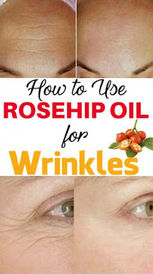 How to Use Rosehip Oil for Wrinkles & Eye Wrinkles