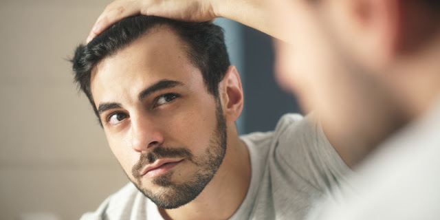 4 Things You Should Know About Male Hair Loss