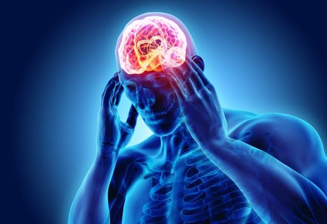 Migraine ; Everything you need to know