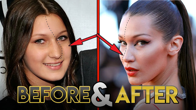 Bella Hadid Reveals Her Plastic Surgery History And How Being Seen As The ‘Uglier’ Sister To Gigi Affected Her