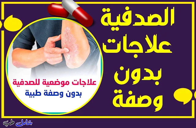 علاجات موضعية للصدفية بدون وصفة طبية؟