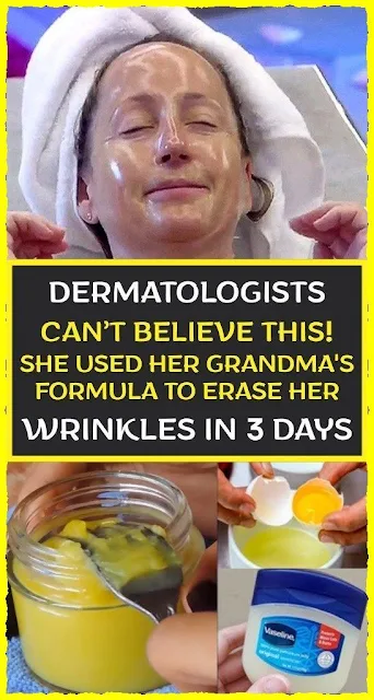 Dermatologists Can T Believe This She Used Her Grandmas Formula To Erase Her Wrinkles In 3 Days