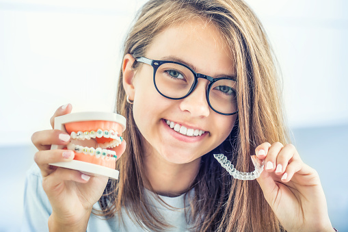 Beauty Woman Wearing Teeth Braces