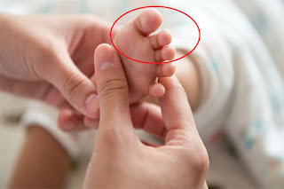 احذر .. هذه العلامة الموجودة على قدم الطفل دليل على تآكل مفصل الركبة