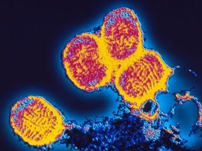 hypercolored image of small pox under a microscope