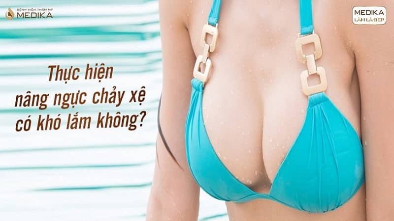 Thời tiết để nâng ngực chảy xệ khi giá bao nhiêu cũng ngại đi AVvXsEh0DEyfsIgZFHUmNCYuo93wqrmAm2ycTea-J0IWooQMGxIbEwP4YAI2KQ2LjZWcojmZcQa3eDKqVOMIYHQAYr-nqIwUMTGvm9Ef2HWw7-JlfdeAcNPD_uzQM9yxGGOy4cQNvqnjGwLTMY8TSEk799xpqHKiTC04cm5CX3zo3yCOB2TJ1K8fBHD1uA=s16000