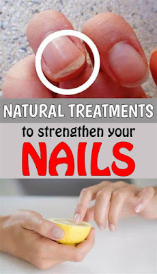 Natural Treatments To Strengthen Your Nails