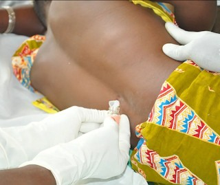 New Disease Outbreak in Nigeria, FG Warns