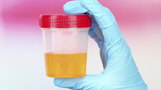 Urinalysis