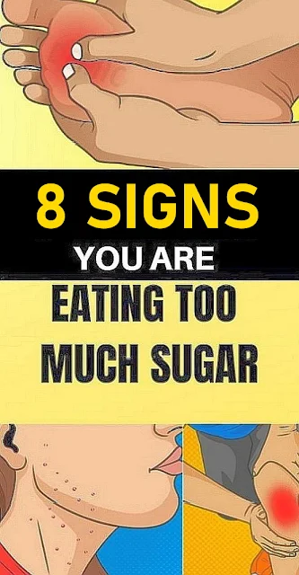 8 signs you're eating too much sugar