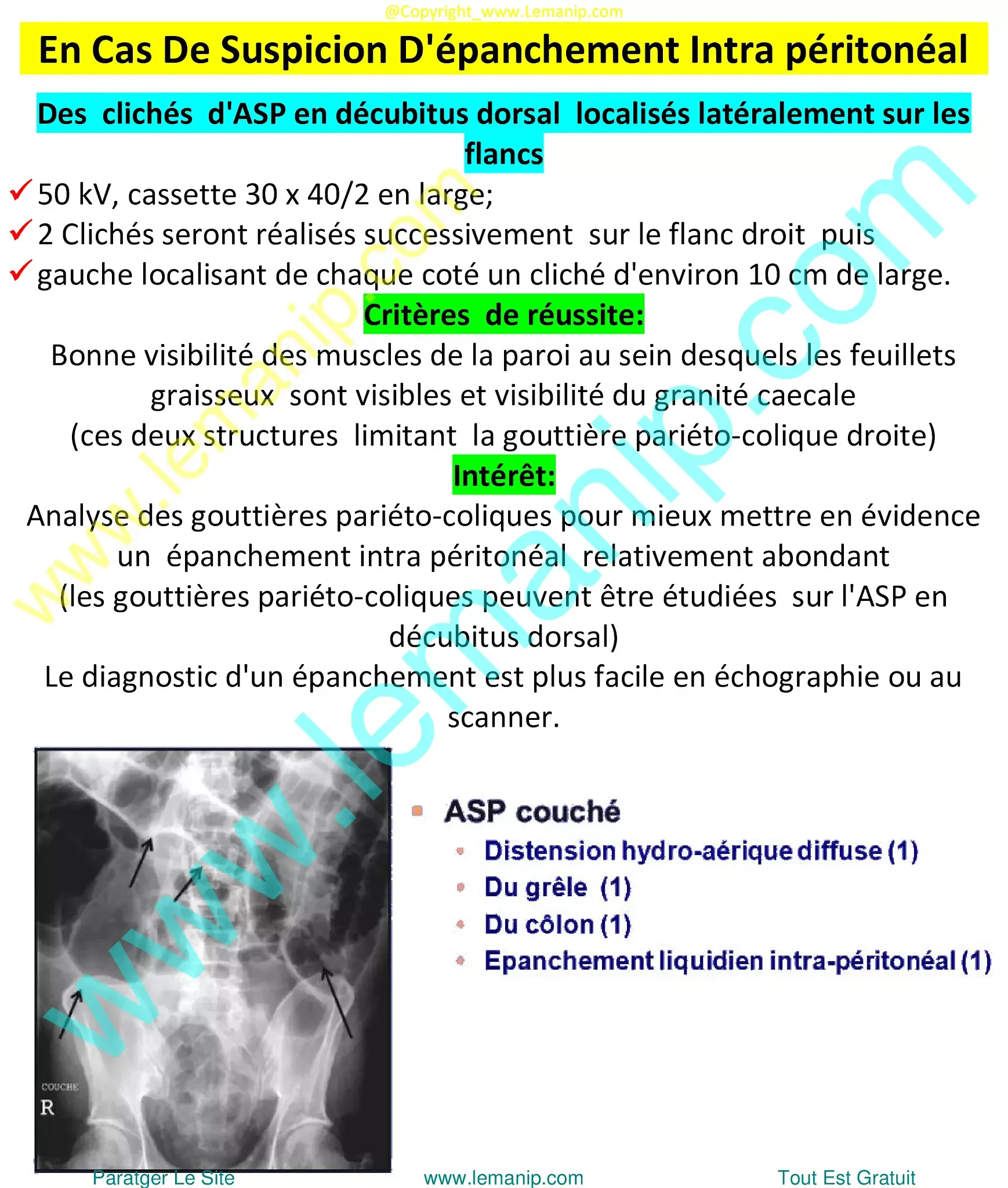 abdominal radiography,abdominal xray,abd xray,belly x ray,x ray on abdomen,xray on abdomen,abdominal xray price,stomach x ray,stomach on xray,pain 2 inches left of belly button after eating,lower back pain that wraps around to abdomen