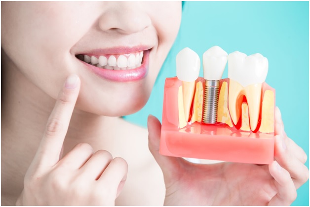 Why Replacing Your Missing Teeth with Dental Implants?