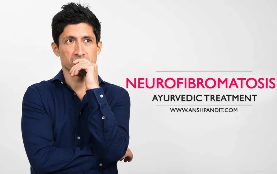 Neurofibromatosis Disease Ayurvedic Medicine in Hindi