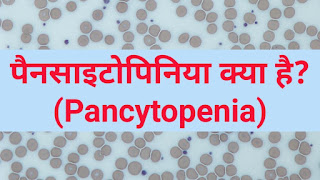 pancytopenia