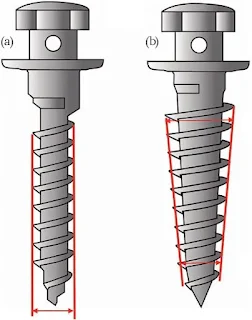 Types of mini-implants