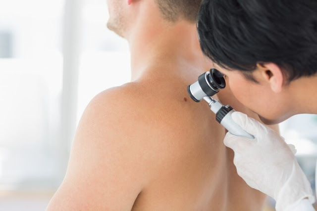 O tipo de câncer de pele com pior prognóstico é o melanoma e, segundo o INCA (Instituto Nacional de Câncer), em 2020 a estimativa de novos casos no Brasil é de 8.450, sendo 4.200 homens e 4.250 mulheres (2020 - INCA).