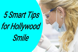 5 Smart Tips for Hollywood Smile