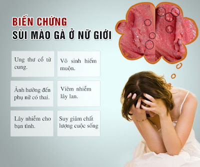 Biến chứng bệnh sùi mào gà ở nữ