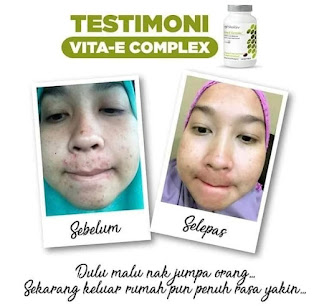 Vita-E Complex Shaklee Testimoni Harga Khasiat Cara Makan