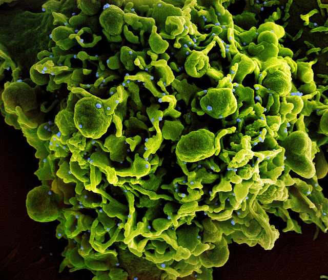 Micrografia eletrônica de varredura colorida de uma célula (verde) infectada com partículas do vírus SARS-CoV-2 (azul, isolada de uma amostra de paciente. Imagem capturada no NIAID Integrated Research Facility (IRF) em Fort Detrick, Maryland. Crédito: NIAID / Science Source