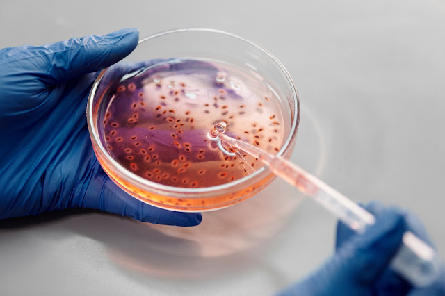 jenis-jenis mikroorganisme yang dapat menghasilkan antibiotik