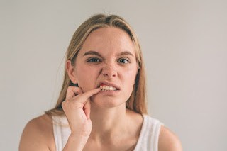 Dấu hiệu nhận biết viêm lợi sau khi bọc răng-3