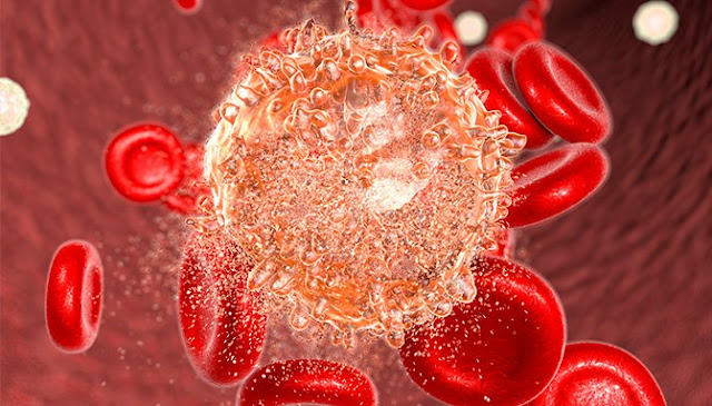 Multipotent hematopoietic stem cells derived from peripheral blood cells, bone marrow, or umbilical cord blood are implanted into the patient during hematopoietic stem cell transplantation.