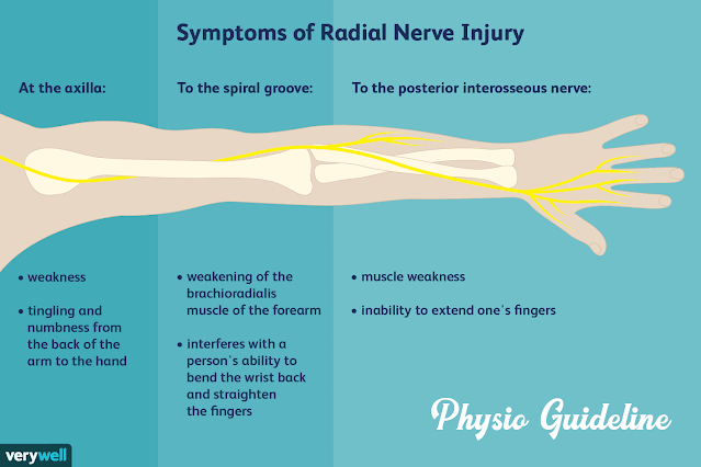 Nerve Injury
