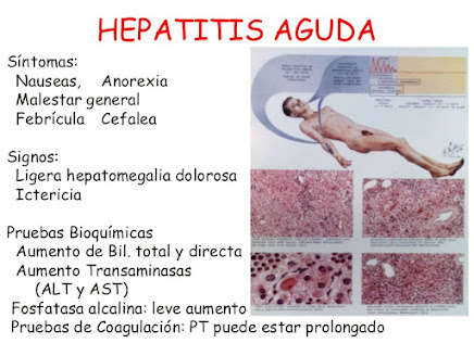 Asegura SS que en México no hay casos de hepatitis aguda grave de etiología desconocida