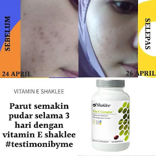 Vita-E Complex Shaklee Testimoni Harga Khasiat Cara Makan