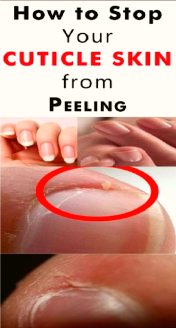 How to Stop Your Cuticles From Cracking and Peeling After a Manicure!!!