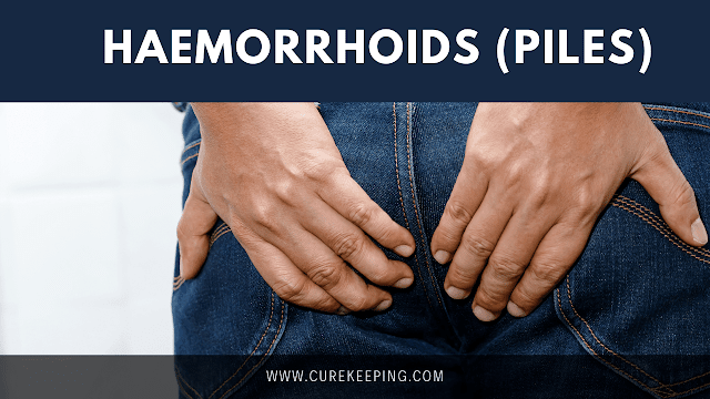 How to cure haemorrhoids