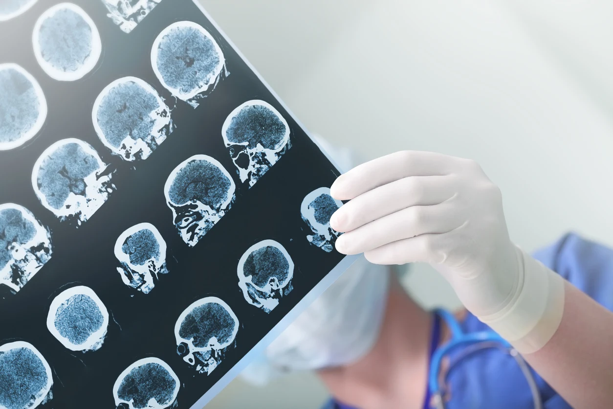 Mais de 1.000 estudos apontam: intervenções naturais podem transformar o tratamento do Parkinson