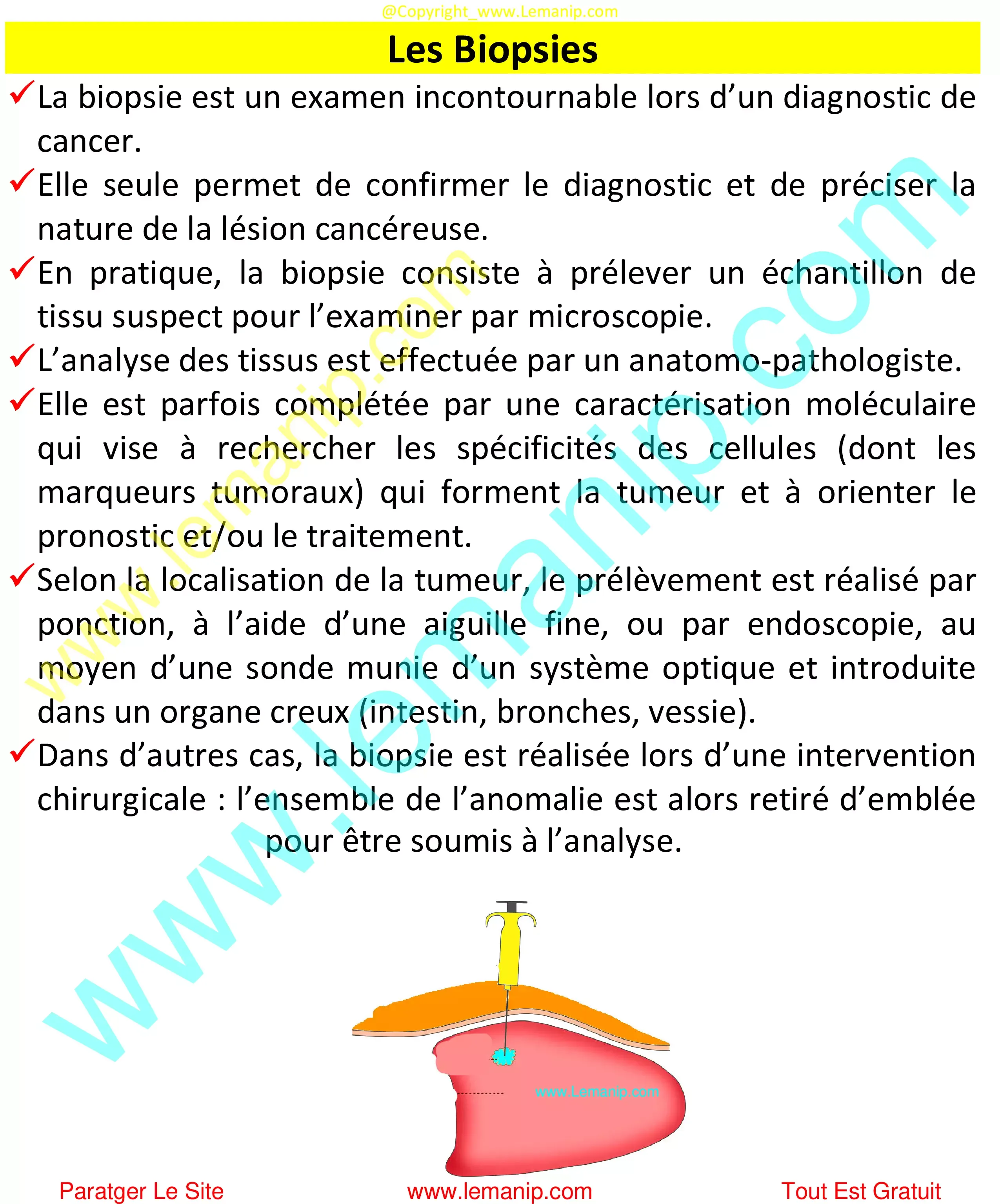 Les Biopsies