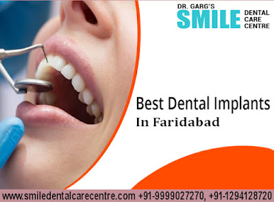 Best Dental Implant Clinic in Faridabad