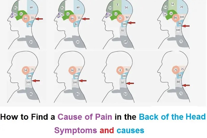 How to Find a Cause of Pain in the Back of the Head?Symptoms and causes