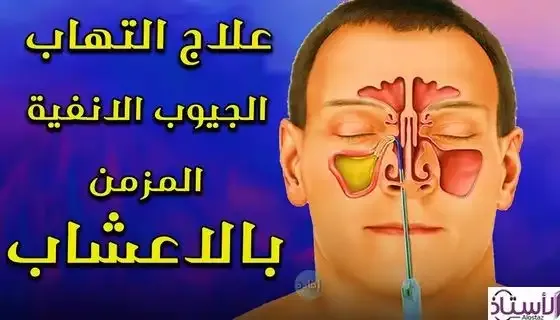 Sinus-treatment-recipes-from-alternative-medicine