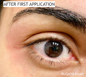 PEACEOUT SKINCARE Retinol Eye Stick Before and After PEACEOUT SKINCARE Retinol Eye Stick Review Results