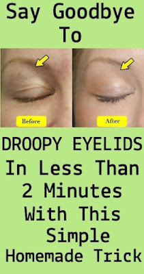 Say Goodbye to droopy Eyelids with these simple Home remedies
