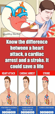 You Must Know The Differences Between A Heart Attack, Cardiac Arrest And Stroke