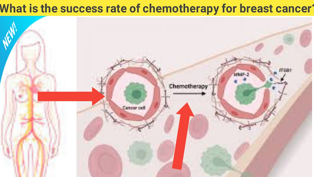 chemo for breast cancer,How long is chemotherapy for breast cancer?,Is chemotherapy for breast cancer painful?,How many rounds of chemo is normal?,Chemotherapy for breast cancer stage 2,Chemotherapy for breast cancer stage 1,How many chemo treatments for breast cancer, Chemotherapy for breast cancer stage 3, Strongest chemo for breast cancer, Chemotherapy drugs for breast cancer stage 4