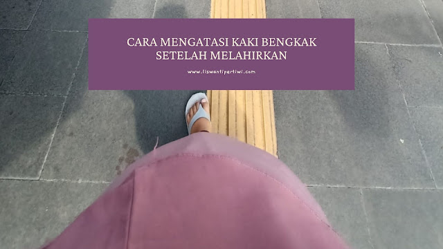 mengatasi-kaki-bengkak-setelah-melahirkan