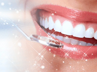 Quy trình niềng răng lệch lạc tại nha khoa-1