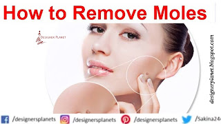 How to Remove Moles || Why a mole may need to be removed.Designerplanet